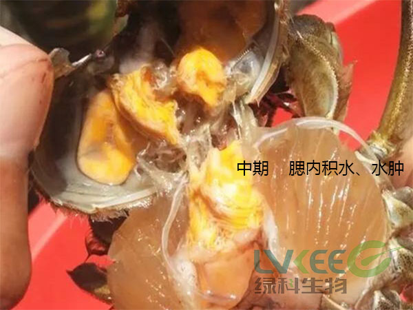 中期 &nbsp; &nbsp;腮内积水、水肿