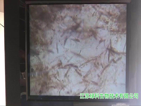 显微镜镜检水霉真菌菌丝体